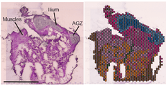 Visium spatial transcriptomics spots overlaid on tissue section